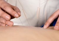 Kerry Acupuncture